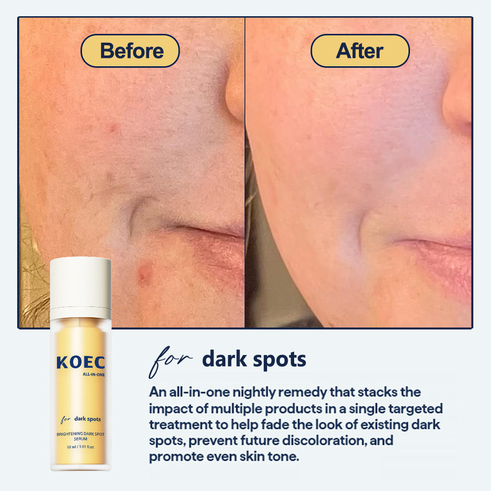 Dark Spot Serum